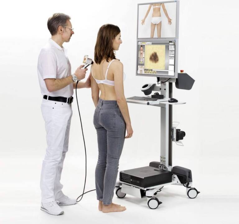 videodermatoskop
