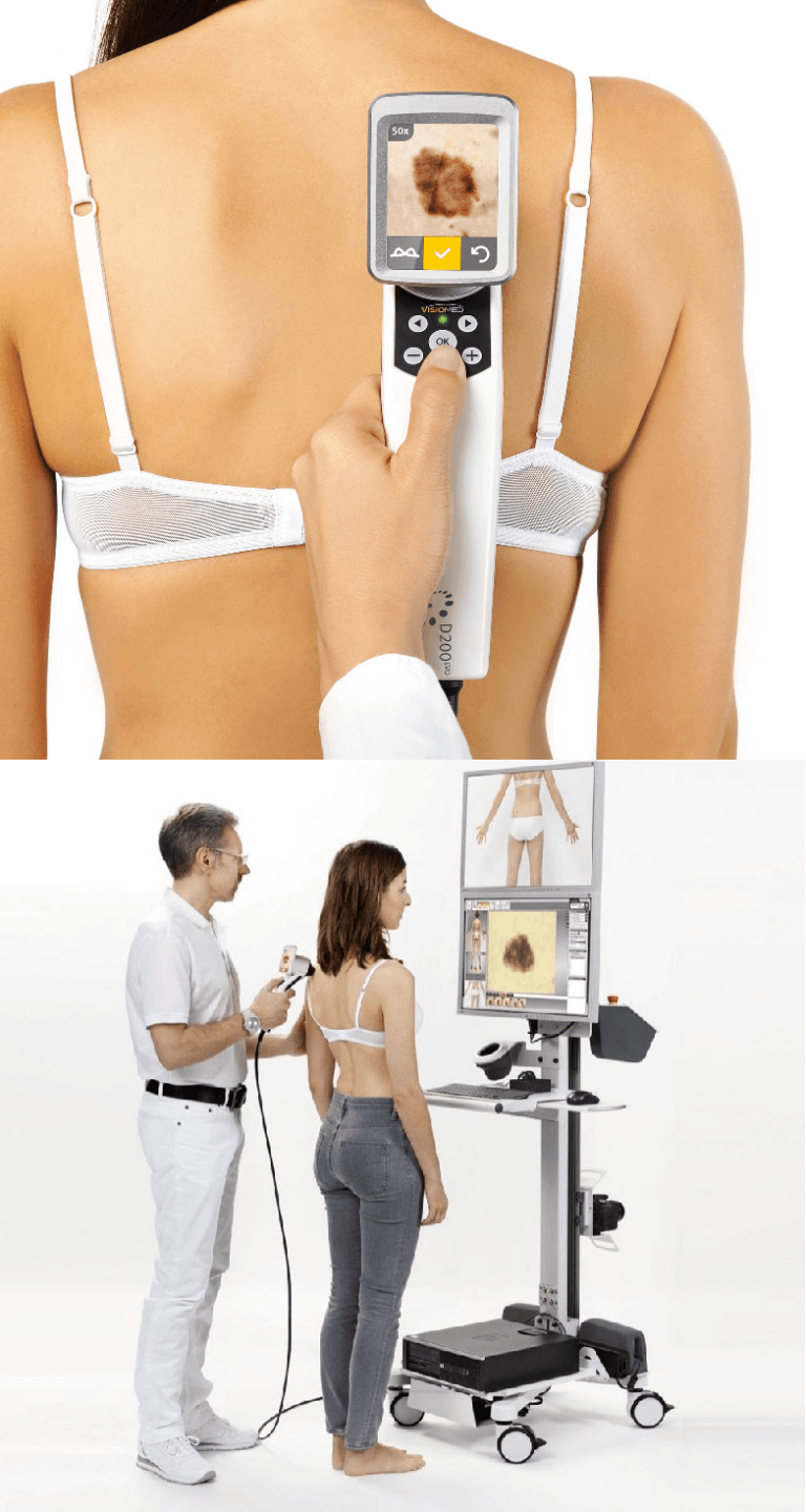 videodermatoskopia