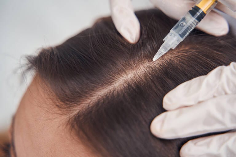 Woman doing head mesotherapy in beauty clinic