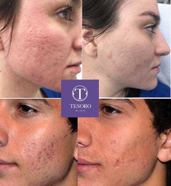tesoro clinic
