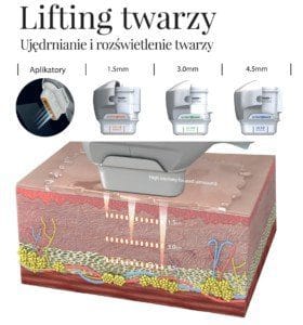 ultraformer 3 na twarz
