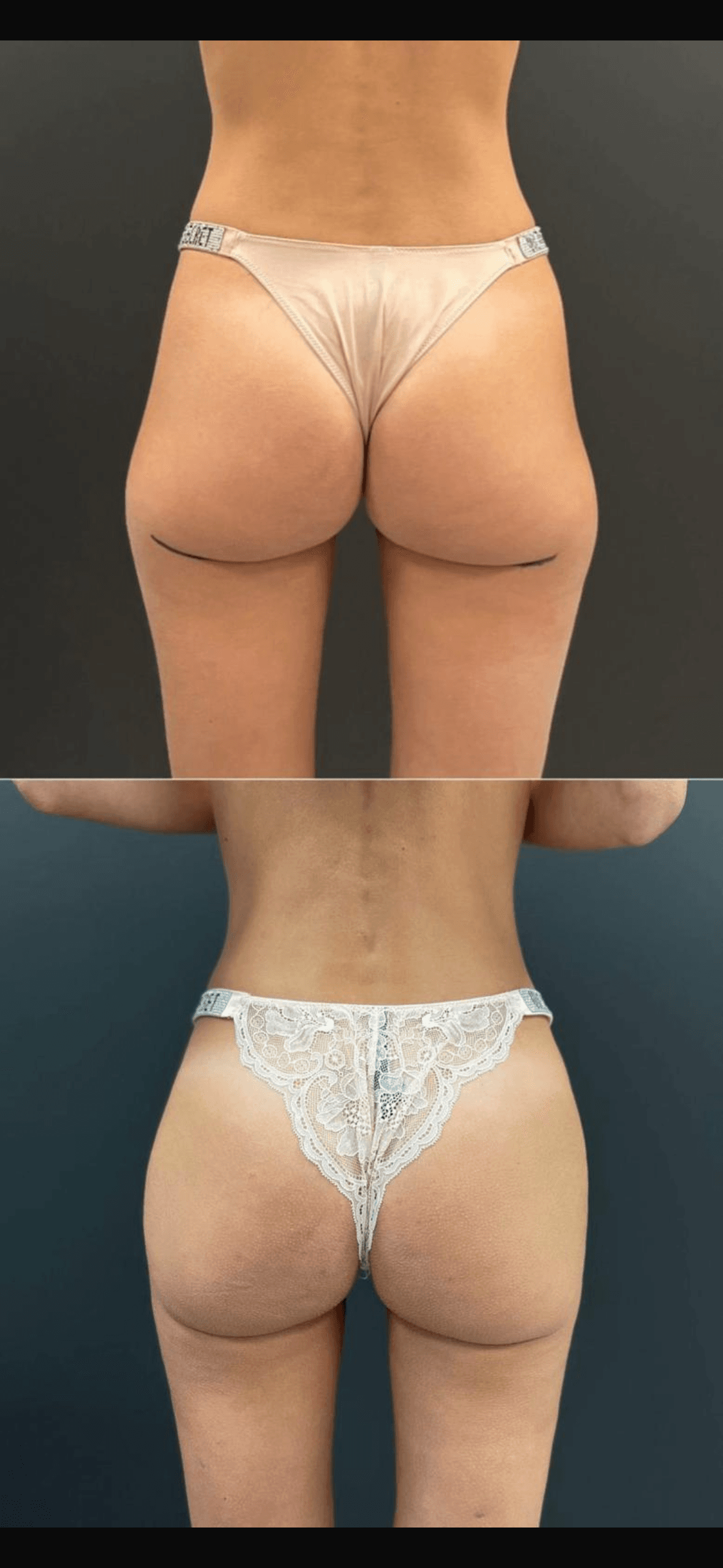 gallery grid image
