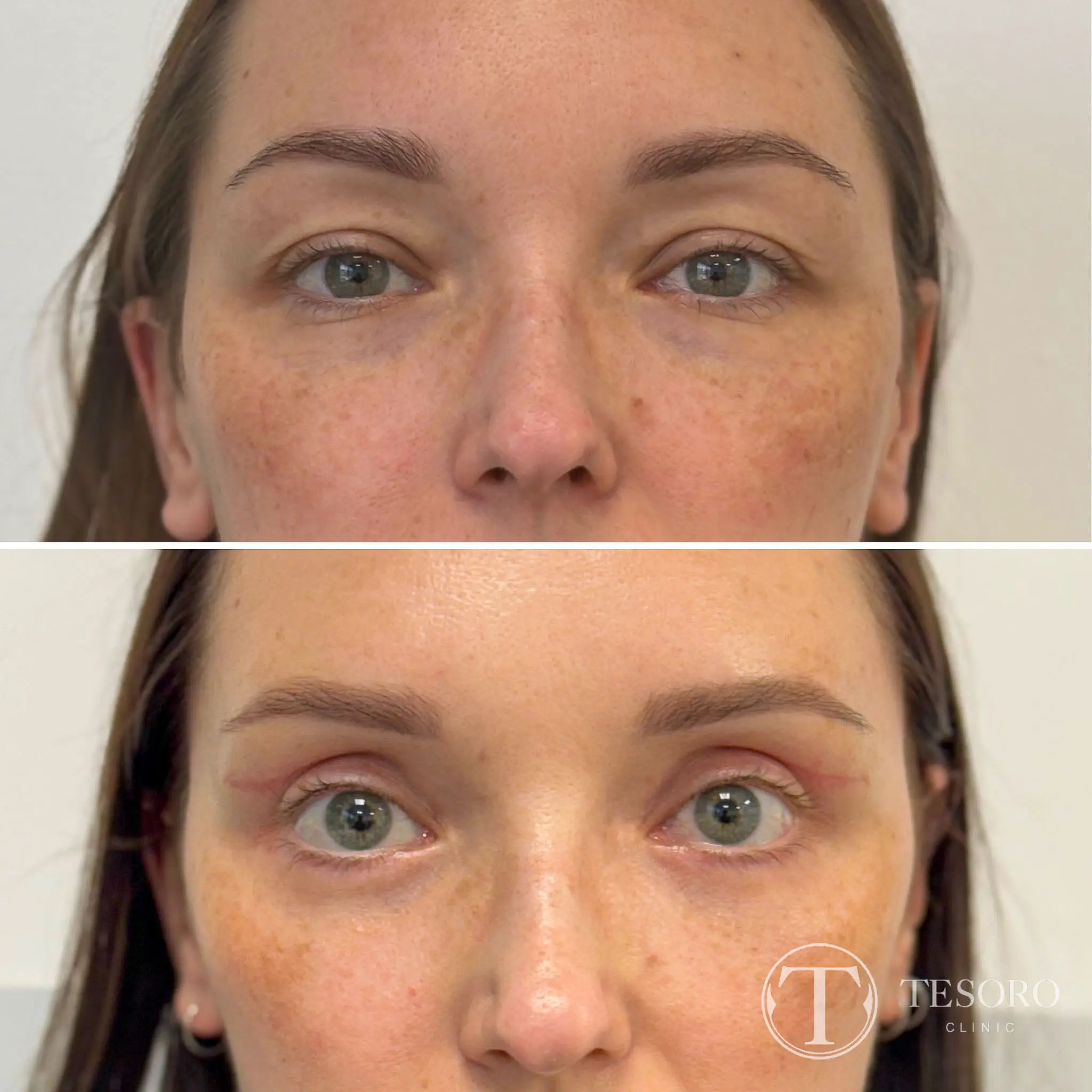 gallery grid image