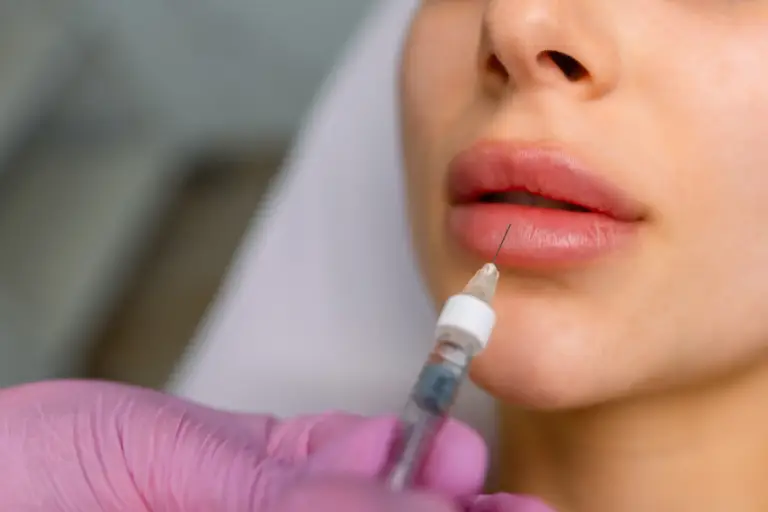 Rozpuszczanie kwasu hialuronowego Hialuronidaza Wrocław Tesoro Clinic